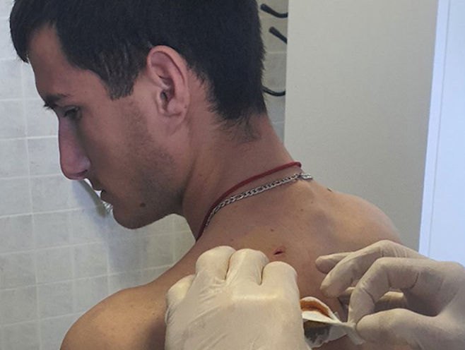 Đuzić stabilno, dvojica napadača na slobodi