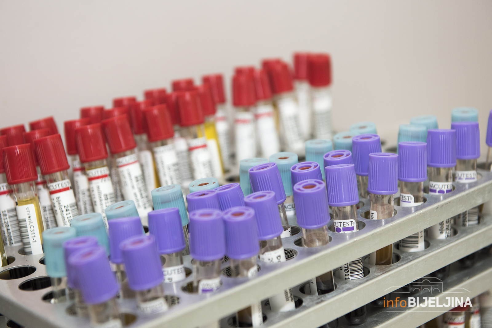 Čak 68 odsto medicinara u Srpskoj ima antitijela