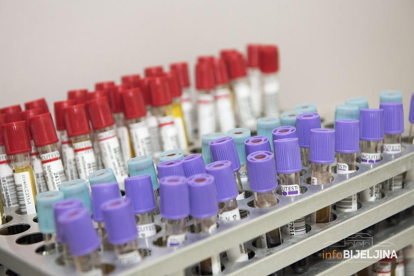 Na virus korona pozitivno još 420 ljudi u Srpskoj, preminulo 19 zaraženih