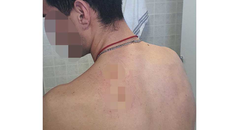 Otac napadnutog mladića moli državu Srbiju za pomoć