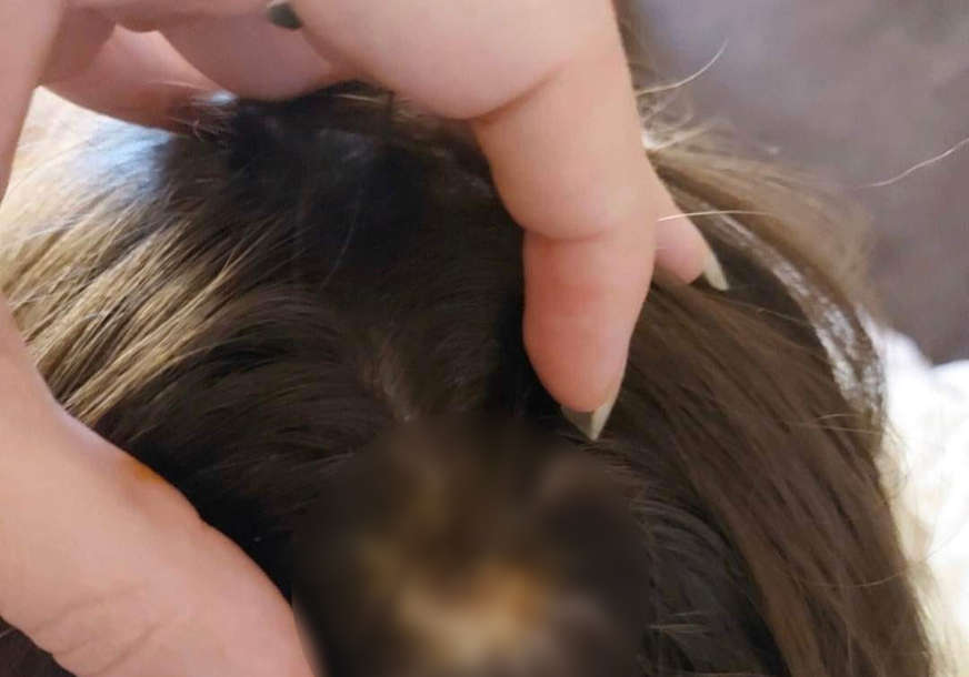 JEZIV SLUČAJ NASILJA Majka kćerkici gasila cigarete po tijelu, baka uzela djecu da ih spasi, pa uhapšena (FOTO)