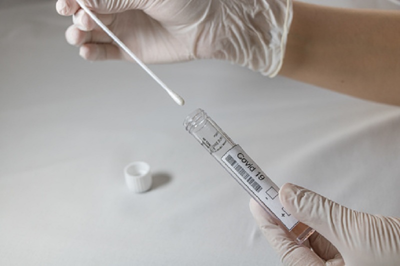 Više od pola ukupno testiranih: U Srpskoj do sada urađeno više od 166.500 PCR testova na virus korona
