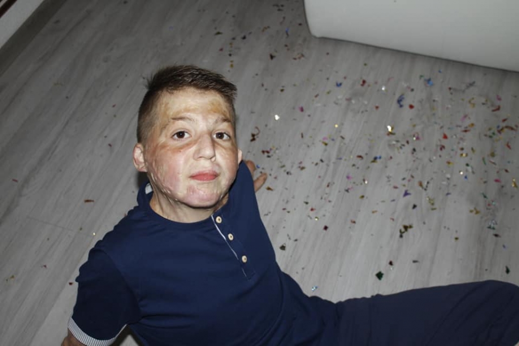 Izdržao ono što mnogi ne bi: Dječak imao MALE ŠANSE DA PREŽIVI nakon vatrene stihije, a danas se vraća životu (VIDEO)