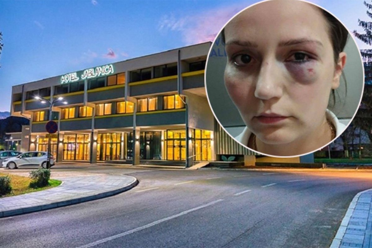 Pretučena radnica iz Jablanice uoči protesta: Očekujem veliki broj ljudi, teško se oporavljam