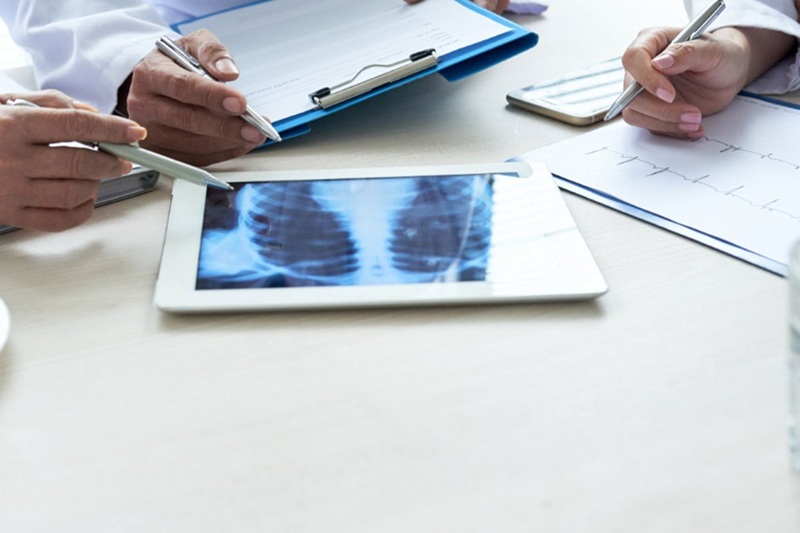 Otišao na rendgen, ljekari se šokirali šta su mu našli u grudima (FOTO)