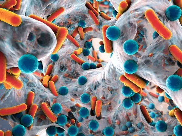Naučnici upozoravaju: Otporna superbakterija širi se bolnicama širom svijeta