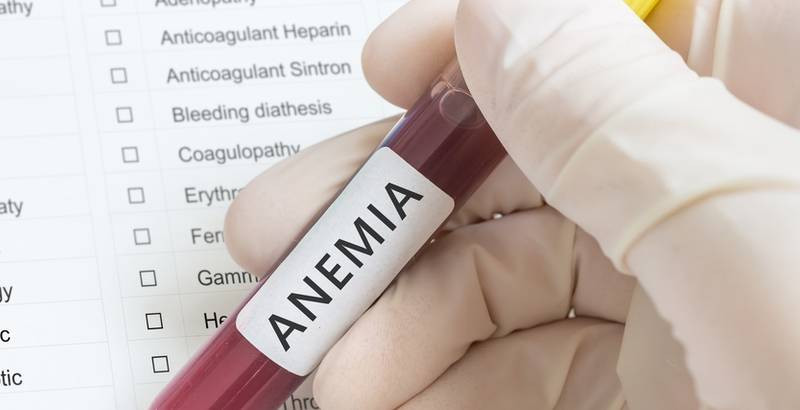 Kratak dah i lupanje srca = anemija