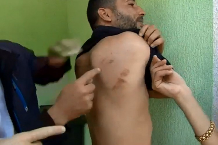 BBC: Hrvatski graničari tuku migrante, pljačkaju ih i ilegalno vraćaju u BiH