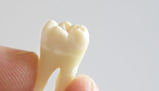 Izvađen najduži zub na svijetu - dugačak 37 milimetara