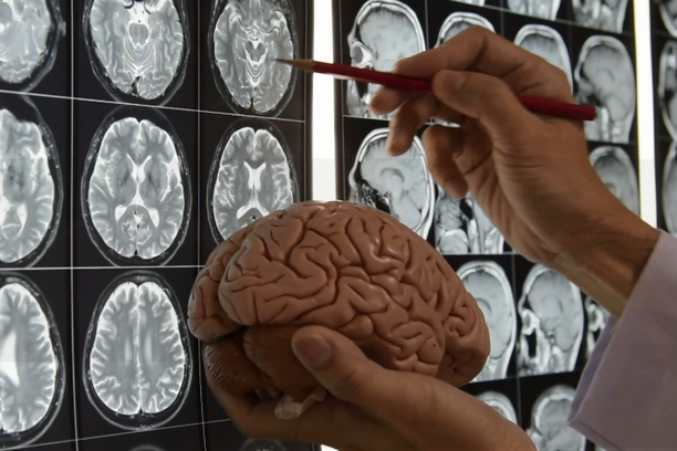 Mozak proizvodi struju dovoljno jaku da napaja sijalicu: Zanimljive činjenice o ljudskom mozgu