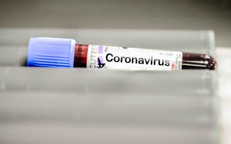 U Srbiji 384 osobe pozitivne na korona virus