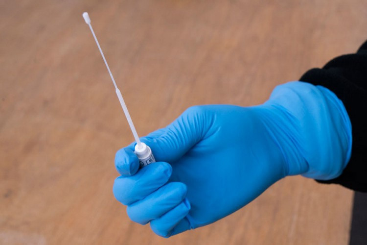 Da li je moguće biti imun na virus korona?