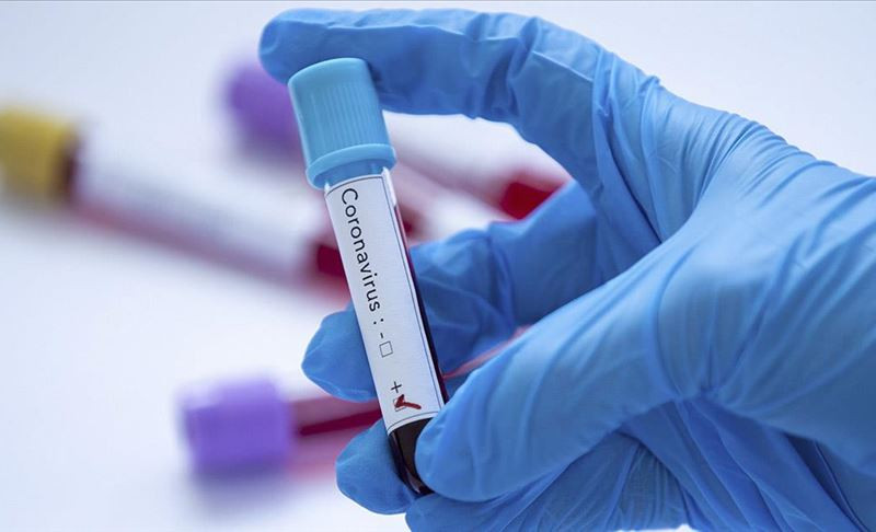 U Srbiji 457 zaraženih: Preminula osma žrtva korona virusa