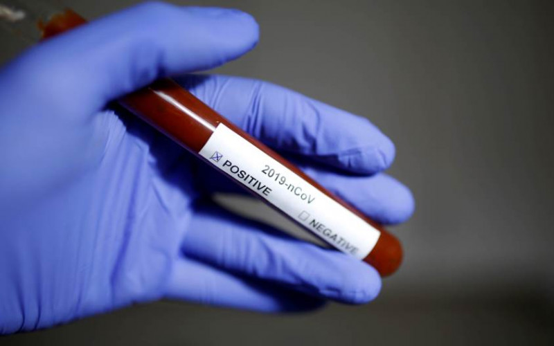 Potvrđena tri nova slučaja zaraze u Sarajevu