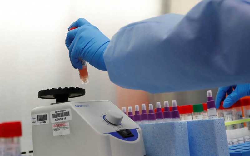 U svijetu 912.000 oboljelih, umrlih 45.540, izliječenih 190.000