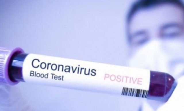 U SAD-u umrlo dijete staro šest sedmica; svijet se bliži milionu zaraženih