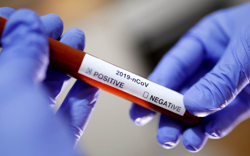 U Srpskoj korona virus potvrđen kod još 15 osoba
