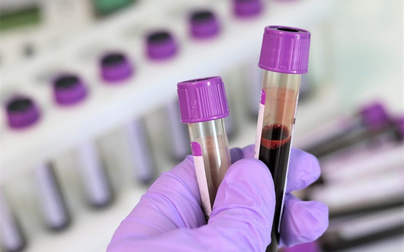 Oporavio se prvi pacijent liječen krvnom plazmom čovjeka koji je preležao koronu