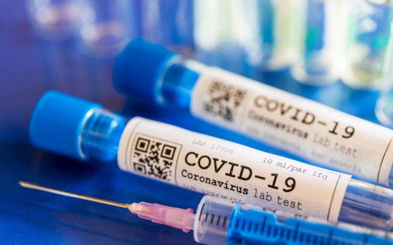 Na korona virus u Srpskoj pozitivne još 22 osobe