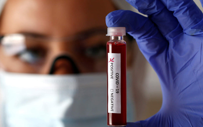 Na korona virus u Republici Srpskoj pozitivno još 12 osoba