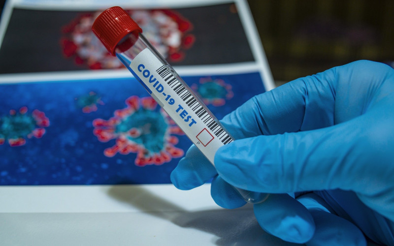 U Srpskoj obavezan test na koronu i za one koji dolaze zbog poslednjeg ispraćaja: Ni na sahranu bez nalaza!