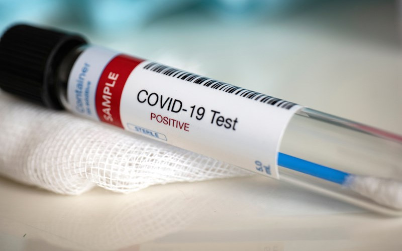 Korona virusom zaraženo još pet osoba u Srpskoj: Dvije osobe preminule