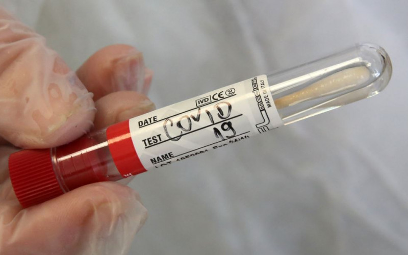 Na virus korona pozitivne još 32 osobe, najviše iz Banjaluke