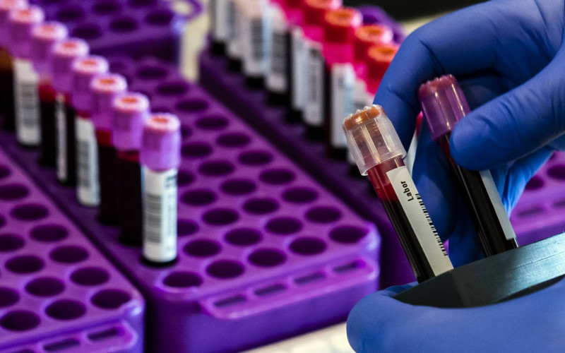 SZO: Rekordan porast broja zaraženih u svijetu