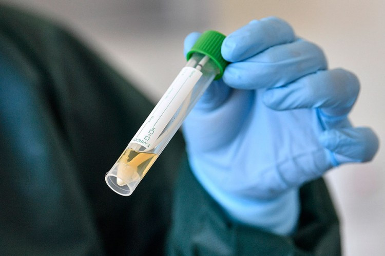 U Stocu čak 50 osoba zaraženo virusom korona
