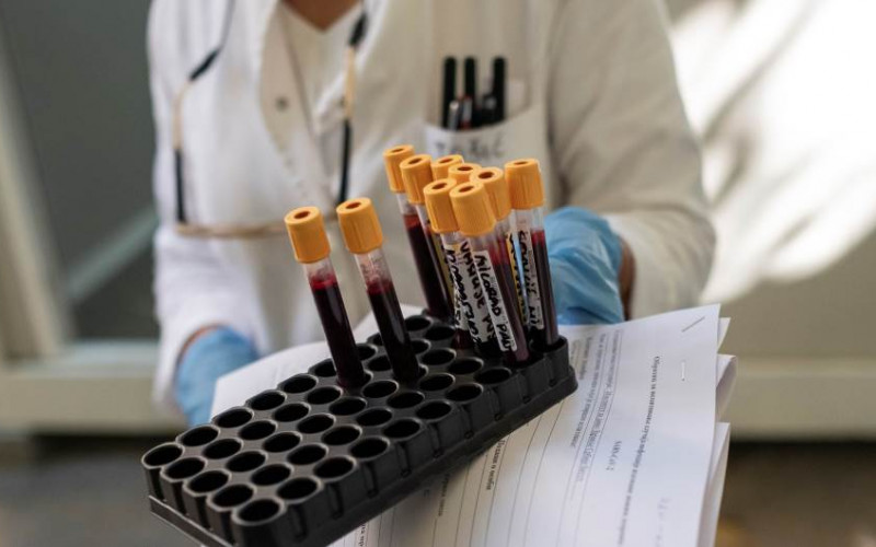 Trenutno u svijetu zaražene 4.506.644 osobe