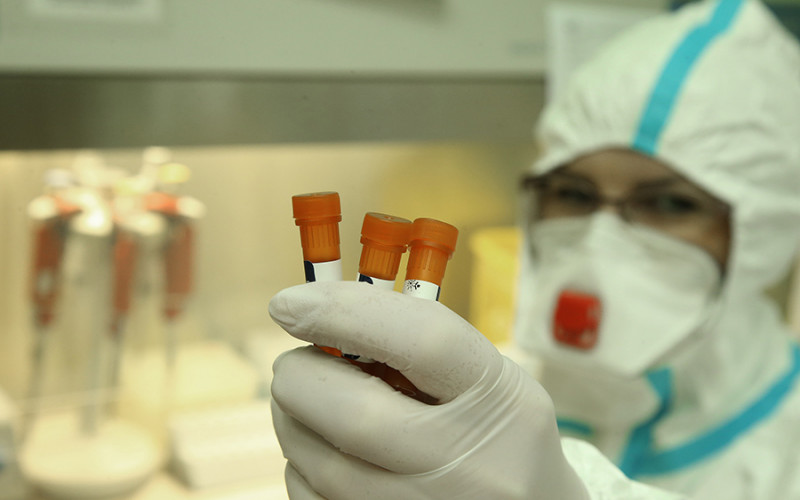 EPIDEMIJA NE JENJAVA Korona virusom zaraženo još 119 osoba u Srpskoj