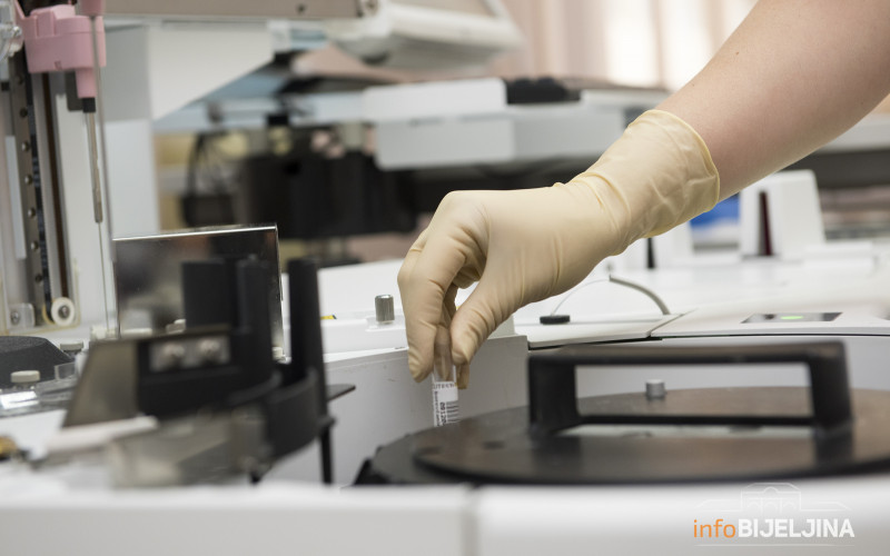 Na korona virus u Srpskoj pozitivno još 85 osoba