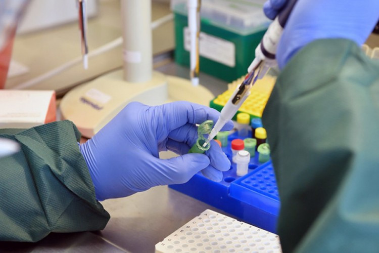 U Srpskoj razmatraju uvođenje JEFTINIJIH USLUGA komercijalnog PCR testiranja