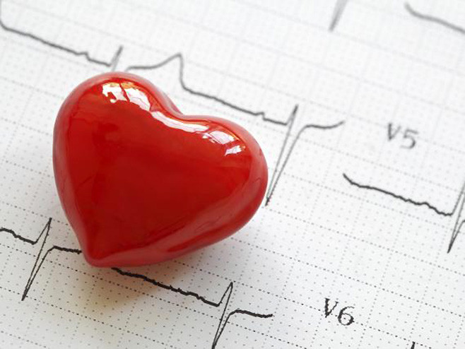 Kardiovaskularna oboljenja prvi uzročnik smrtnosti u Srpskoj