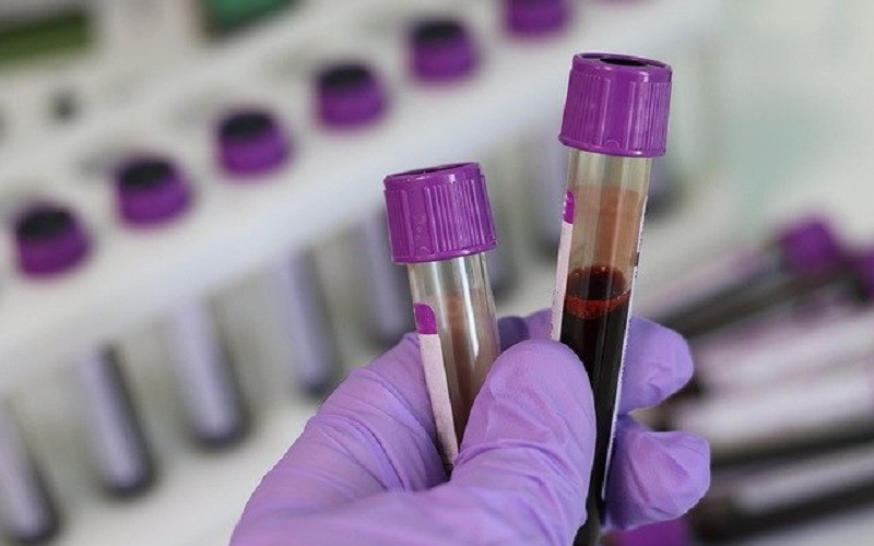U Republici Srpskoj virus potvrđen kod još 39 osoba