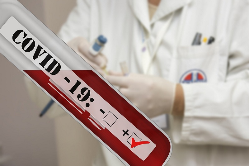  Novi PCR aparat za dijagnostiku virusa korona u Srpskoj