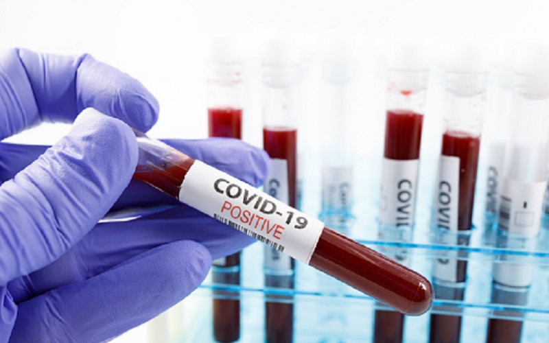 Korona virus potvrđen kod još 387 osoba u Srpskoj