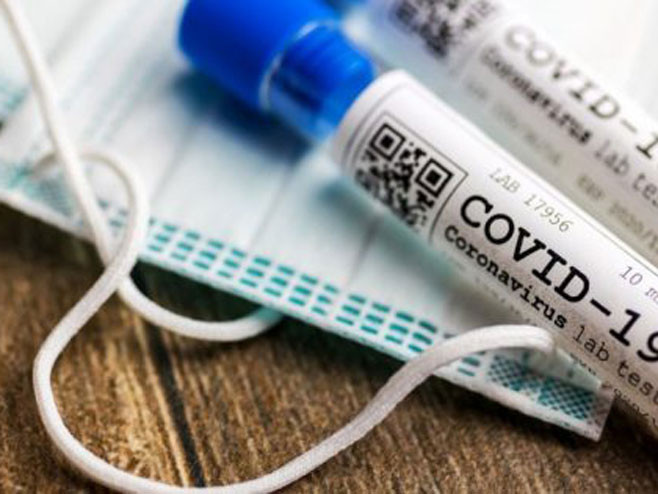 U Srpskoj 362 novooboljelih