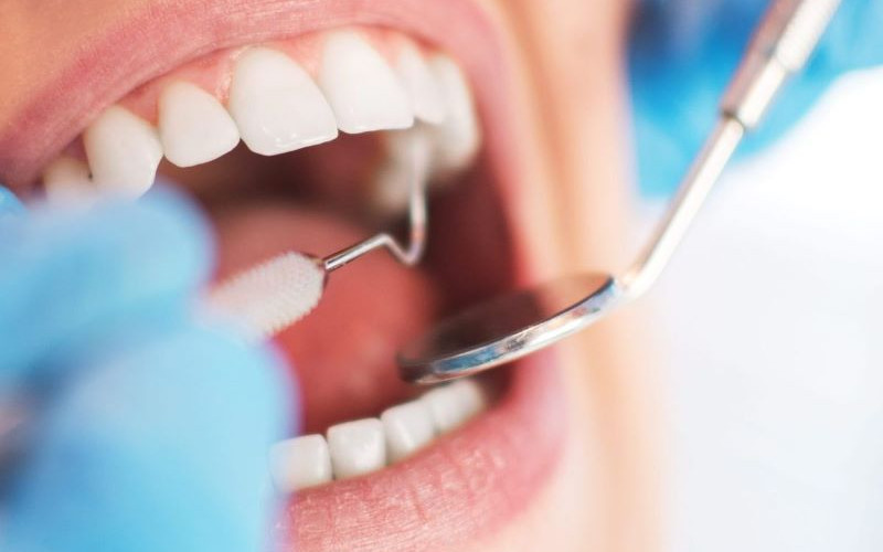 Može li korona oštetiti vaše zube i usta?