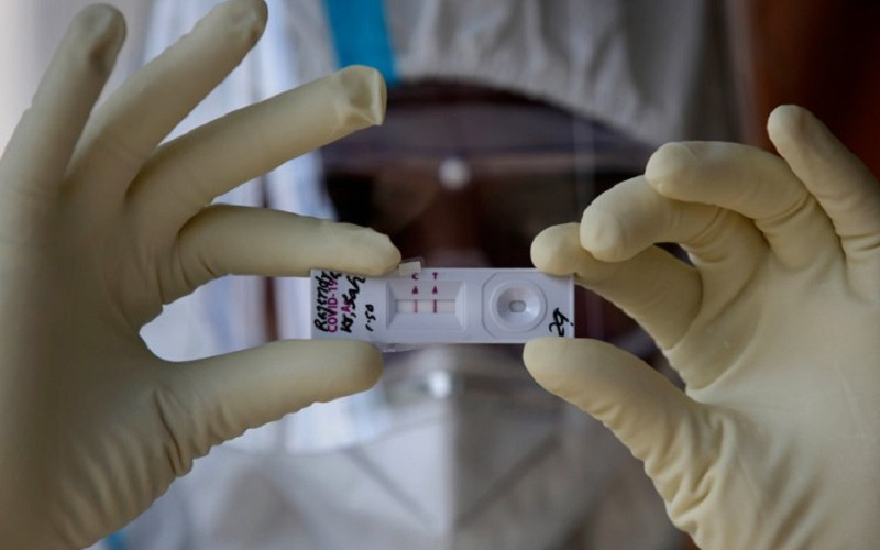 Naučnik: Od masovnog testiranja biće malo koristi, a dosta štete