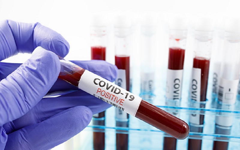 NA VIRUS TESTIRANO 273 GRAĐANA Zaraženo još 83, umrlo 26 ljudi