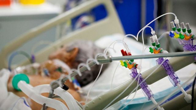 Dr Lukić ističe da mehanička ventilacija POVEĆAVA RIZIK za kardiovaskularne probleme