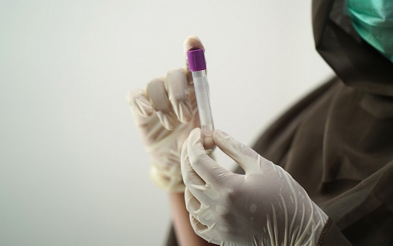 RADNO I TOKOM PRAZNIKA Komercijalno testiranje na VIRUS KORONA moguće 2. i 6. januara