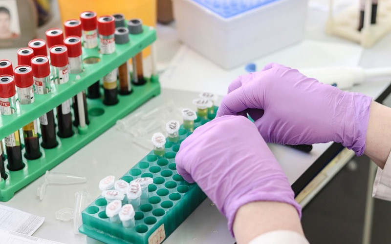 Komercijalno testiranje na virus korona i tokom praznika