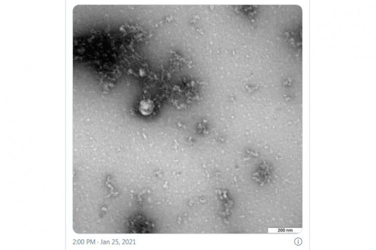 Rusi napravili prvu fotografiju novog soja korone