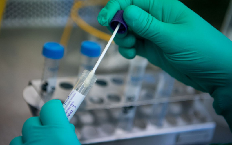 Osam preminulih u RS, virus potvrđen kod 134 osobe