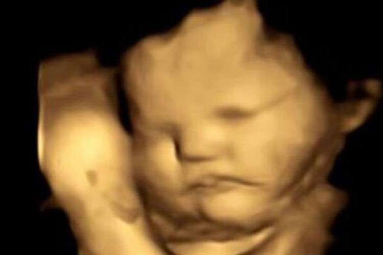 I nerođene bebe u majčinim stomacima „slažu face“ kada probaju kelj