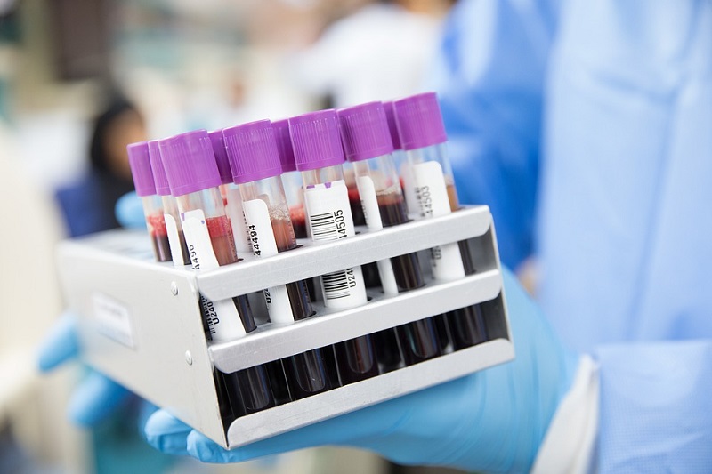  Na korona virus u Srpskoj pozitivna jedna osoba, preminuo jedan pacijent