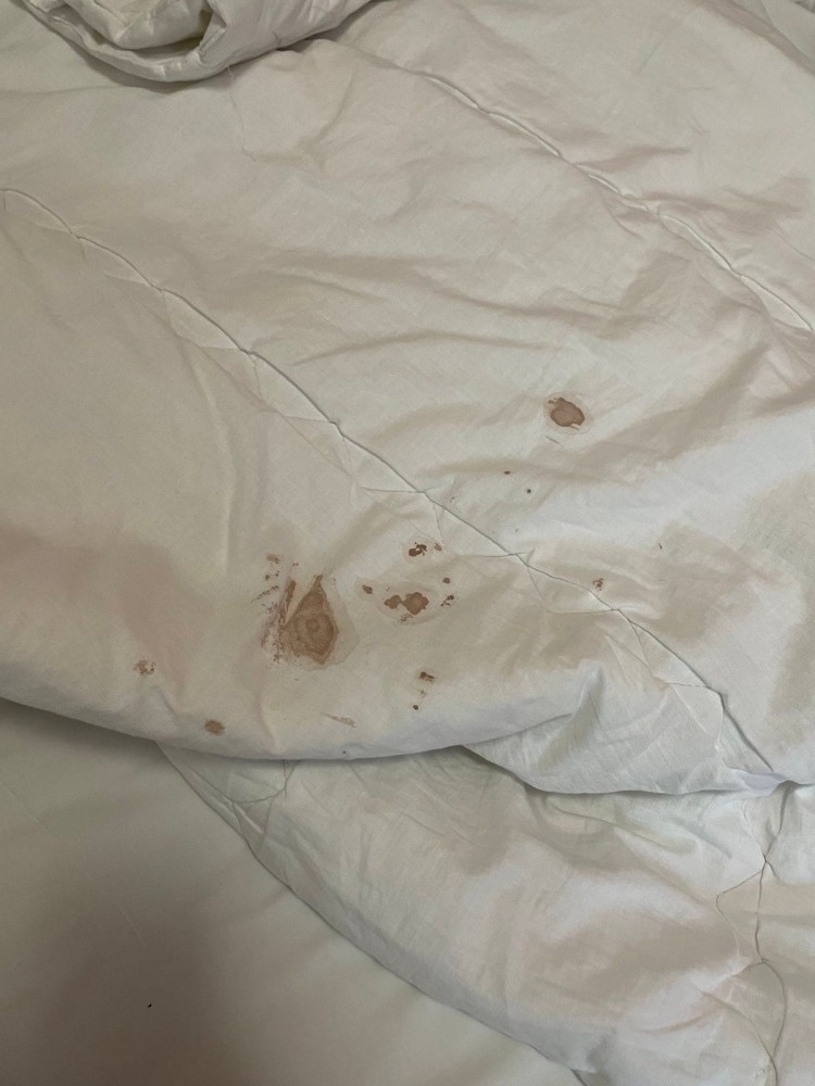 Smeće i jogurt sa isteklim rokom: Osnovci iz Banjaluke nezadovoljni uslovima u hotelu Putnik, roditelji zgroženi