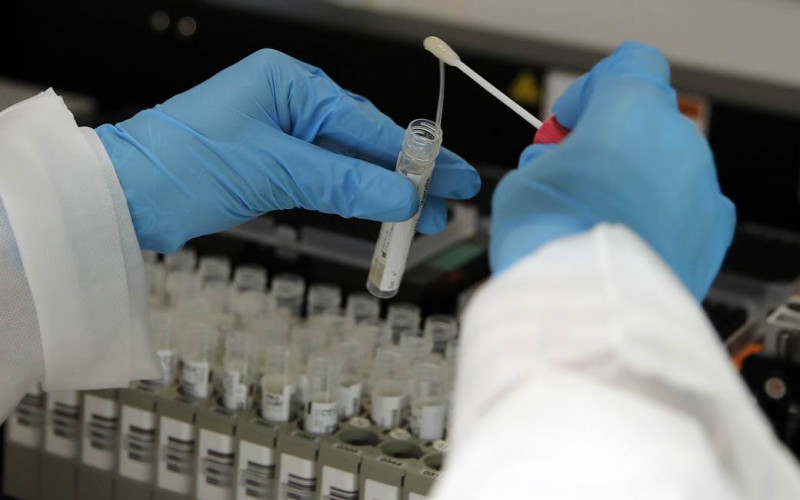 Potvrđena 83 nova slučaja korone u RS, preminulo dеsеt osoba